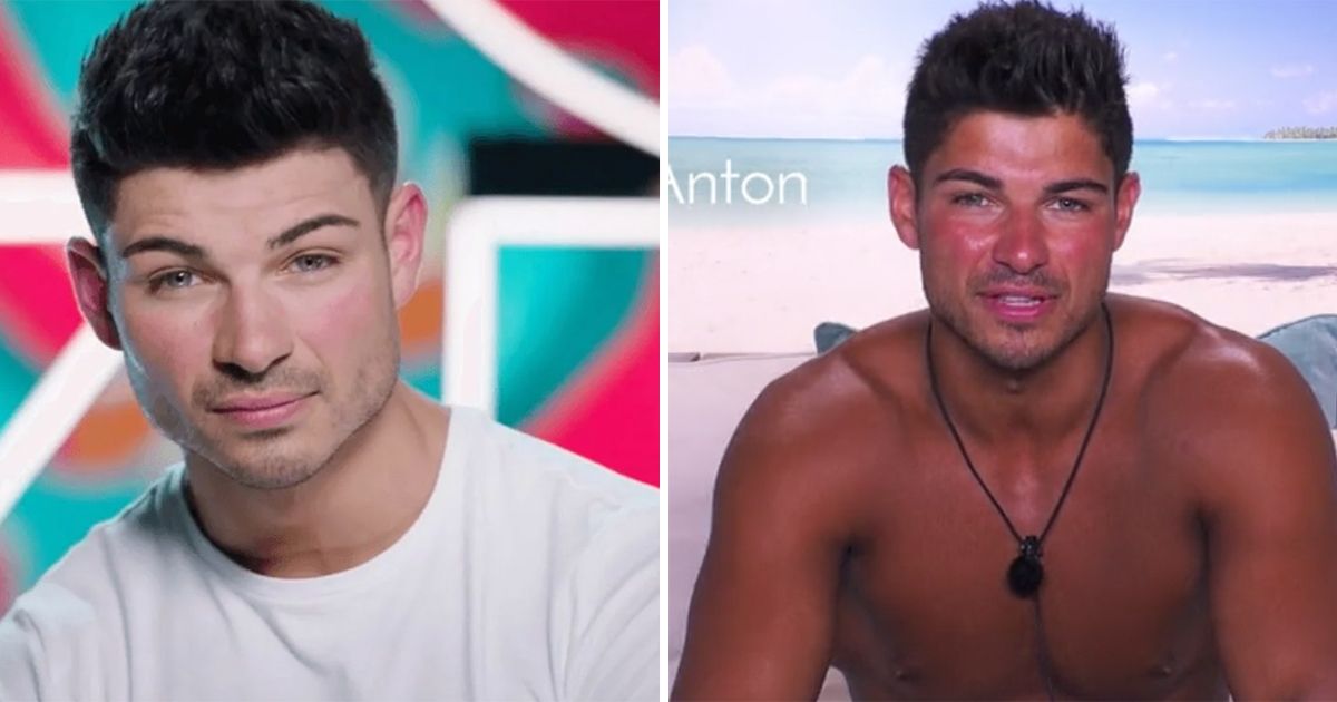 Image may contain: Love Island tans, Love Island, tan, burn, sun, before, after, tanformation, Anton, Boy, Accessories, Necklace, Accessory, Jewelry, Man, Face, Human, Person