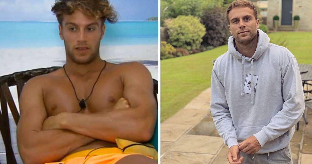 Image may contain: Love Island transformations, Love Island, 2015, series one, Max Morley, then, now, before, after, plastic, cosmetic, surgery, filler, lips, boob job, veneers, teeth, glow up, change, Face, Man, Human, Person