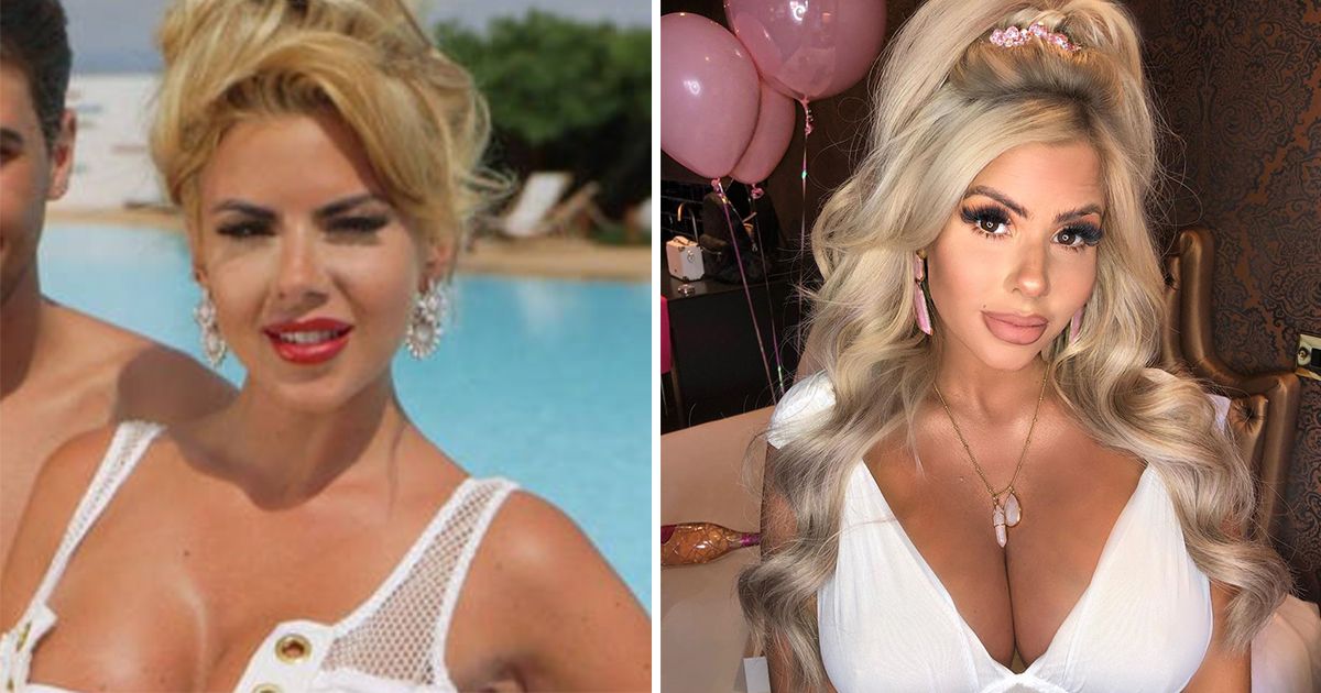 Image may contain: Love Island transformations, Love Island, 2015, series one, Hannah Elizabeth, then, now, before, after, plastic, cosmetic, surgery, filler, lips, boob job, veneers, teeth, glow up, change, Photo, Portrait, Photography, Smile, Female, Hair, Human, Face, Person