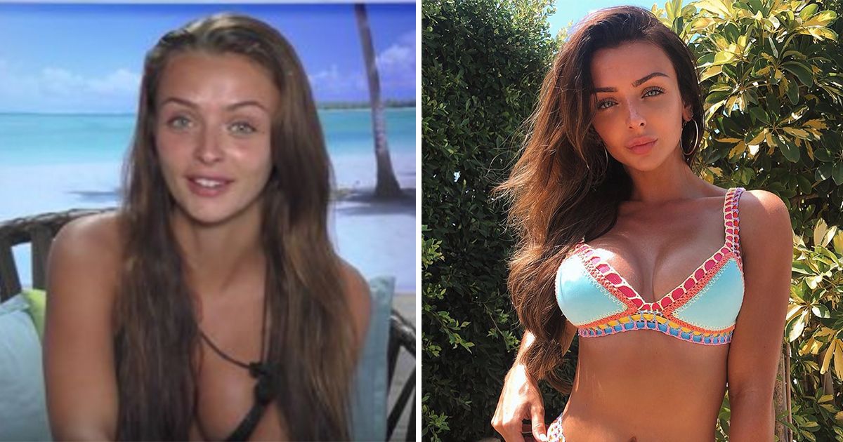 Image may contain: Love Island transformations, Love Island, 2016, series two, Kady McDermott, then, now, before, after, plastic, cosmetic, surgery, filler, lips, boob job, veneers, teeth, glow up, change, Woman, Portrait, Photography, Photo, Dating, Vacation, Female, Skin, Smile, Swimwear, Bikini, Face, Clothing, Apparel, Human, Person