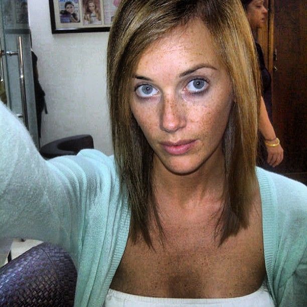 Image may contain: Hair, Freckle, Human, Person, Face