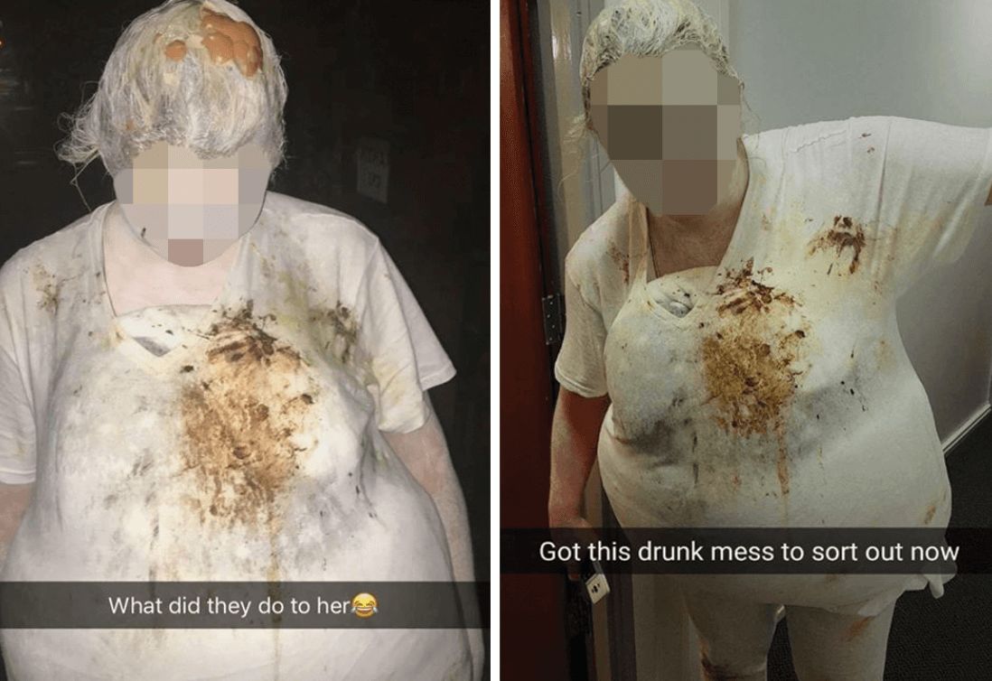 Image may contain: Head, Skin, Face, Person, Human