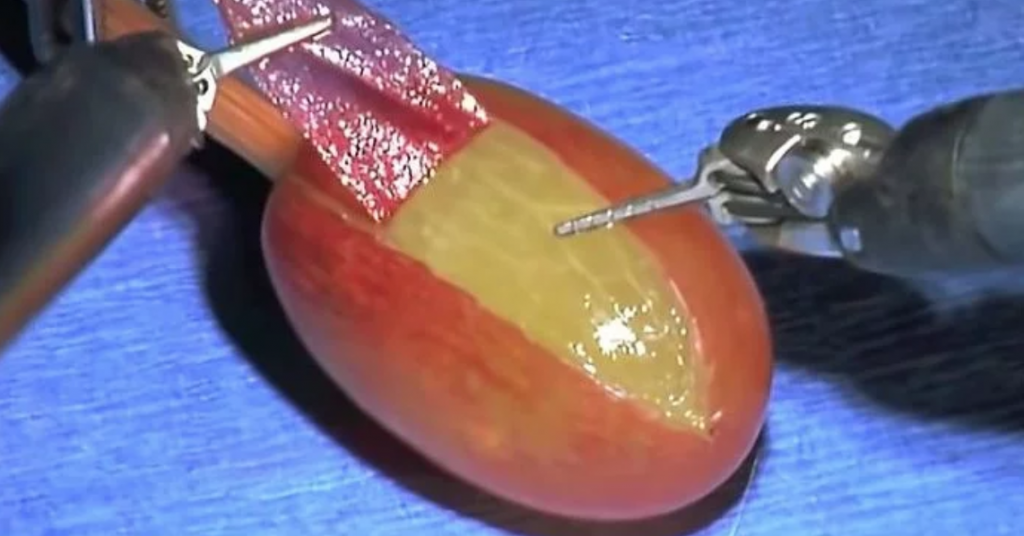 meme origins, meme, memes, explained, story, stories, behind, origin, start, they did surgery on a grape