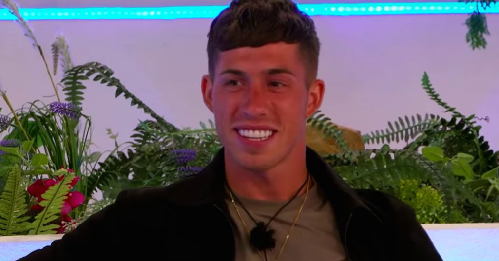 connor's veneers love island