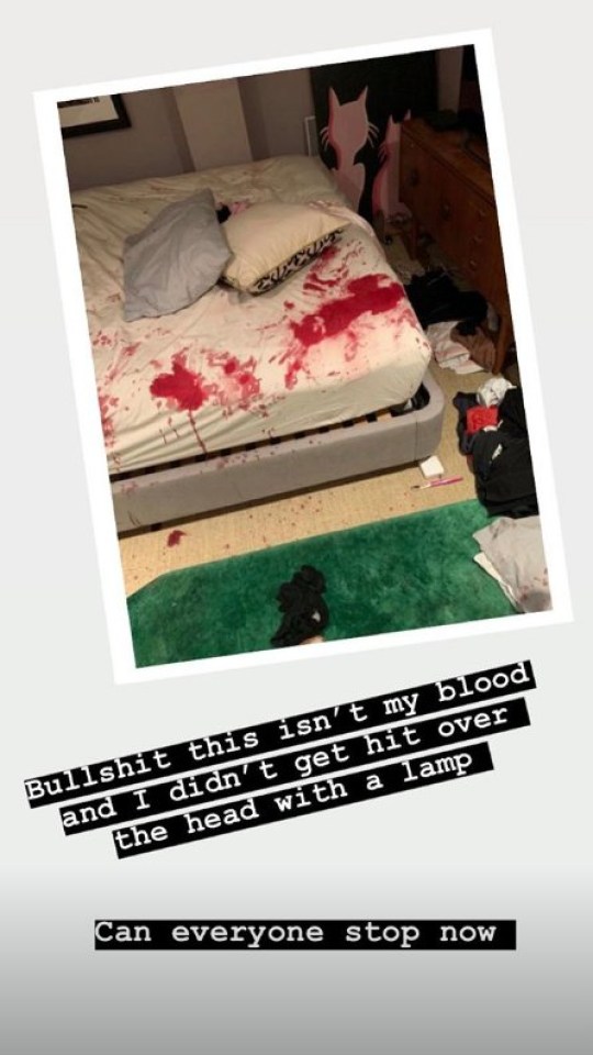 Caroline Flack, fight, boyfriend, update, news, flat, London, inside, Lewis Burton, blood, sheets, stain, bed, assault, boyfriend, court, Love Island,