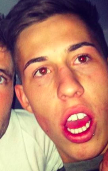connor veneers love island