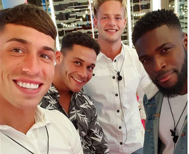 connor's veneers love island