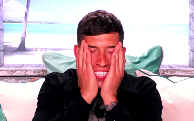 connor's teeth love island