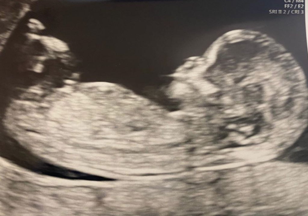 Dani Dyer, pregnant, baby, boyfriend, Instagram, Love Island