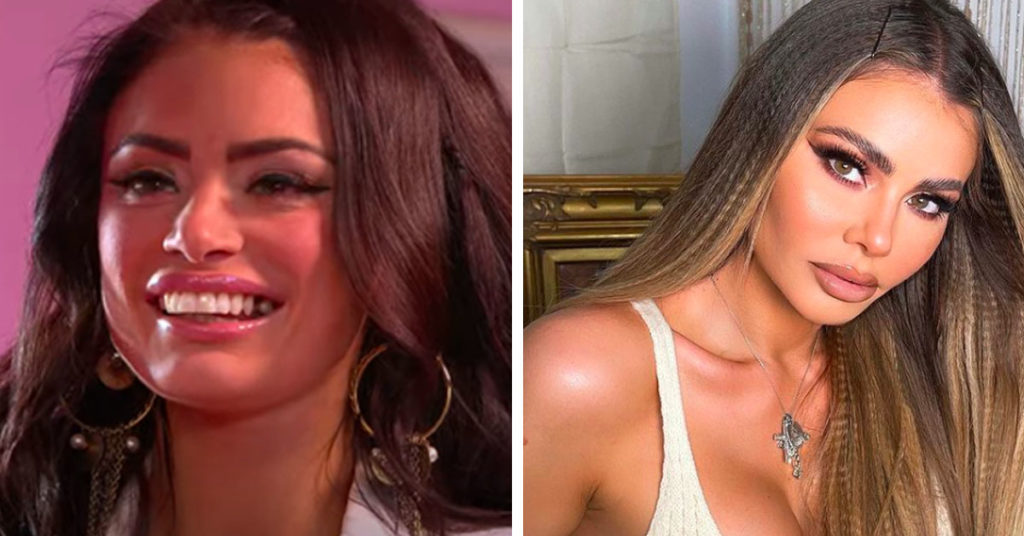 reality stars cosmetic surgery