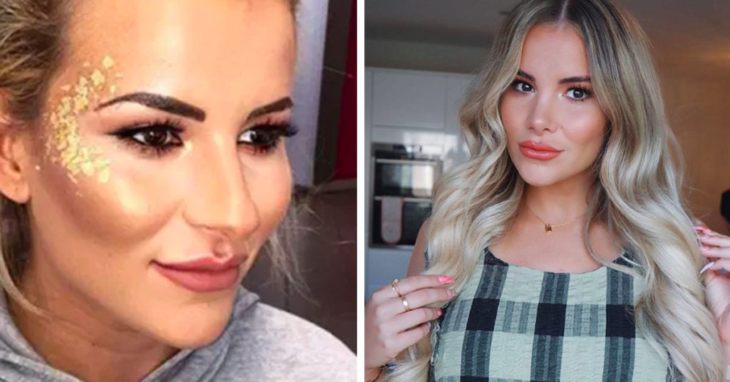 reality stars cosmetic surgery