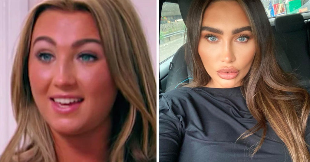 reality stars cosmetic surgery lauren