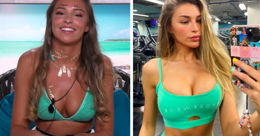 reality stars cosmetic surgery