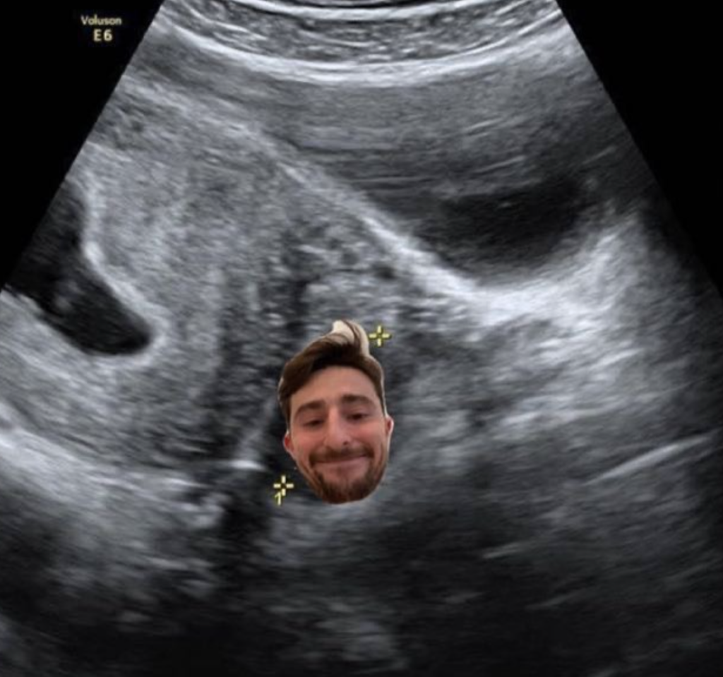 pete-gogglebox-baby
