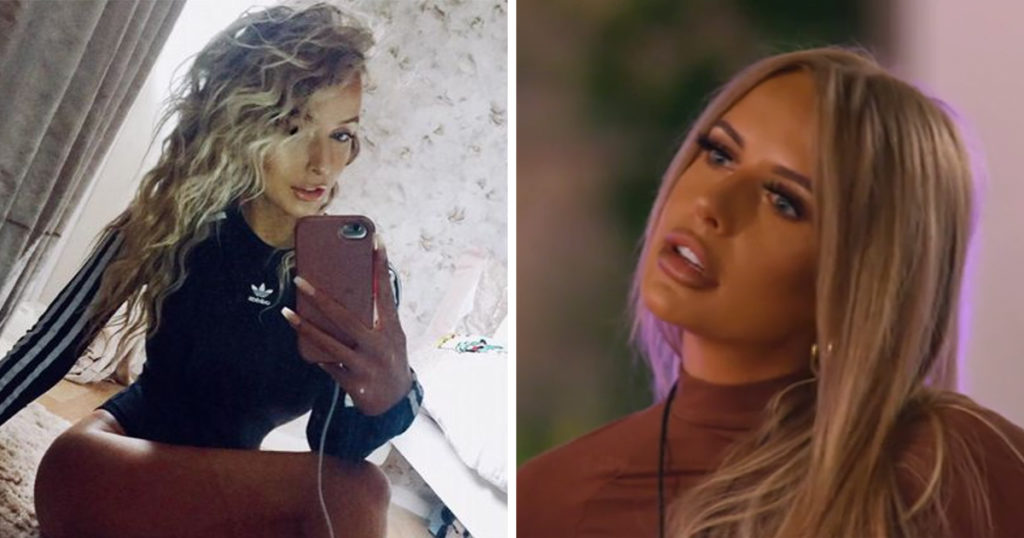 Faye Winter: Love Island 2021 cast transformations and what cosmetic surgery and procedures Islanders have had done
