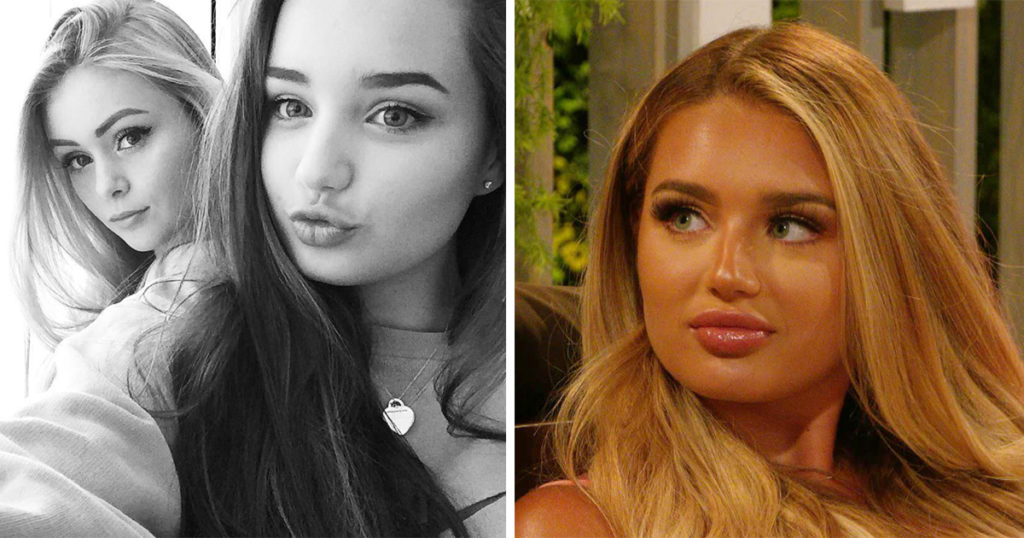 Lucinda Strafford: Love Island 2021 cast transformations and what cosmetic surgery and procedures Islanders have had done