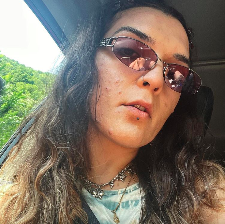 acne, instagram, influencers