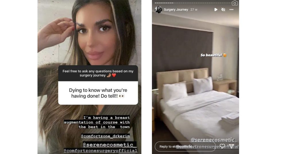 All the cosmetic surgery and work Ekin-Su had before the Love Island 2022 villa