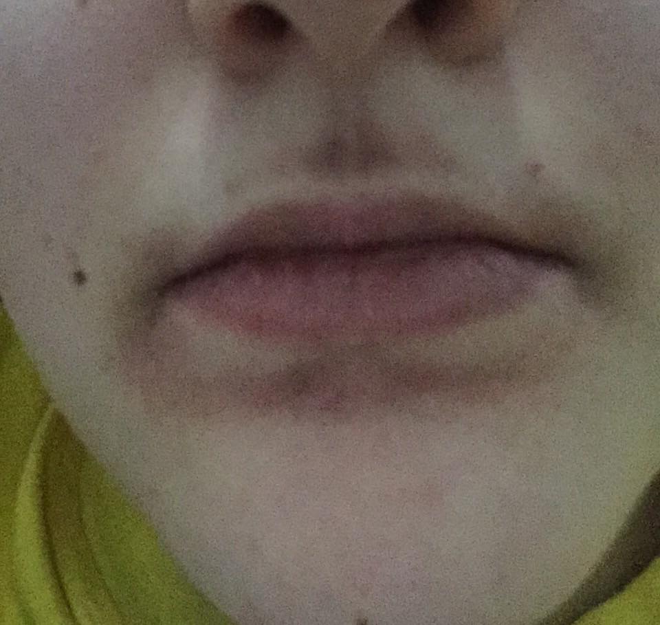 lips1