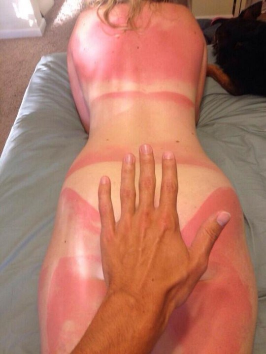 burnnnn-540x720