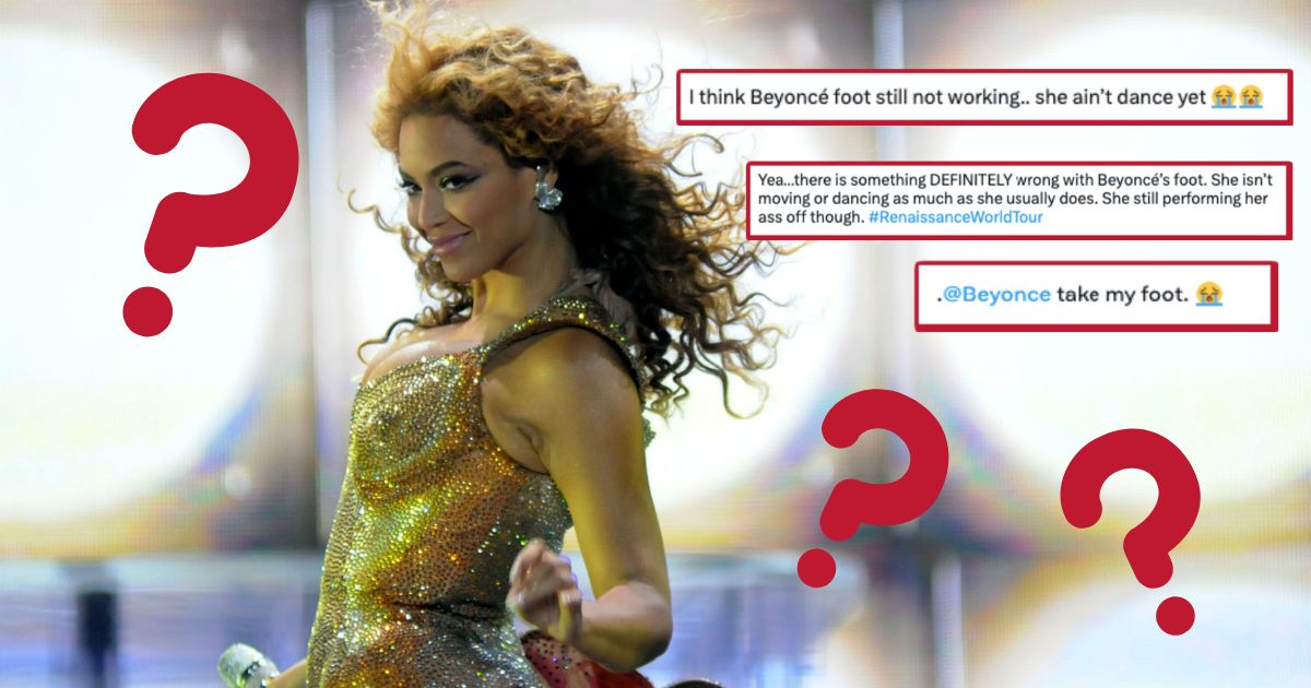 Beyoncé's foot What surgery did she have before her Renaissance tour?