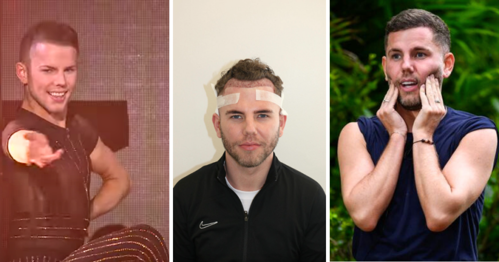 dean im a celeb britain's got talent