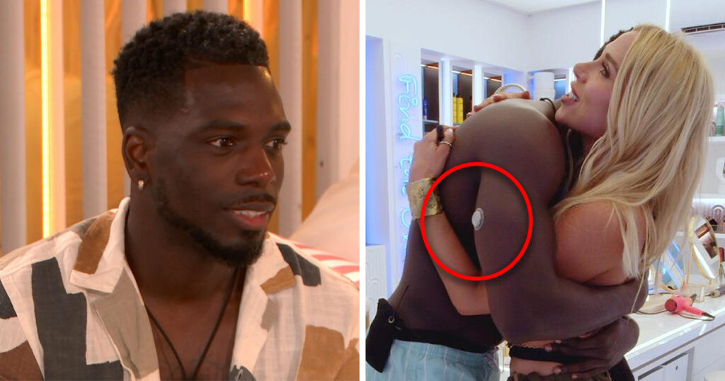 Marcel wearing a patch in Love Island All Stars villa