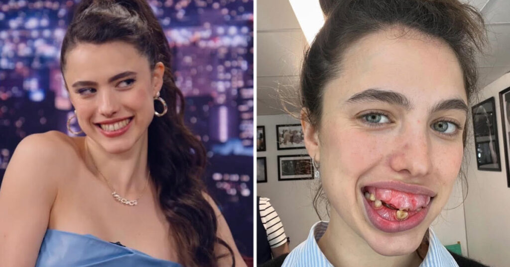 Margaret Qualley The Substance prosthetics