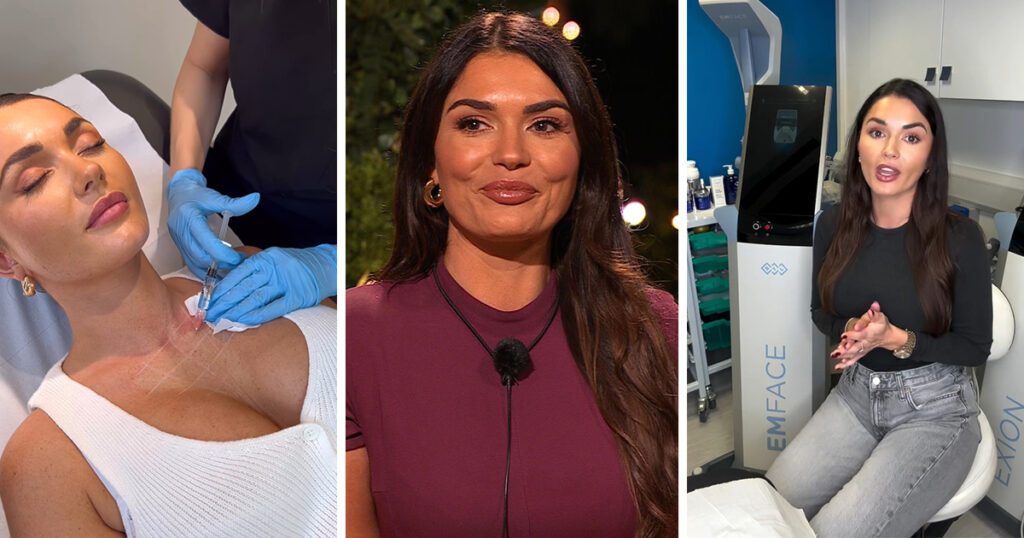 India Reynolds cosmetic work and transformation for Love Island All Stars