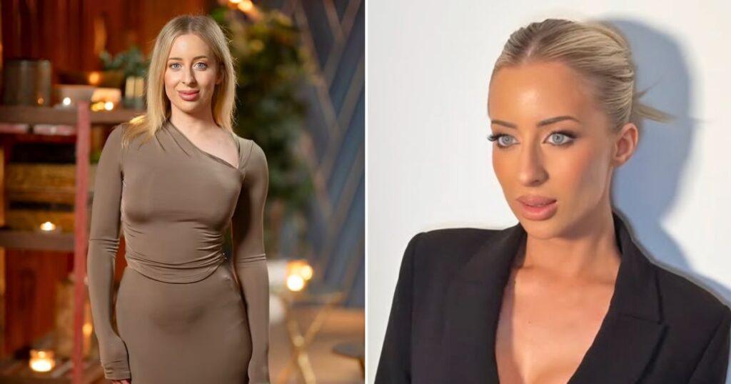 mafs australia 2025 jamie marinos cosmetic surgery
