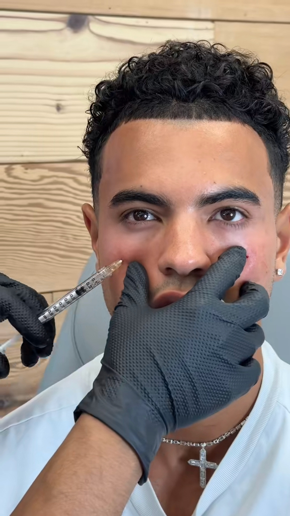 Love Island 2025 cast surgery