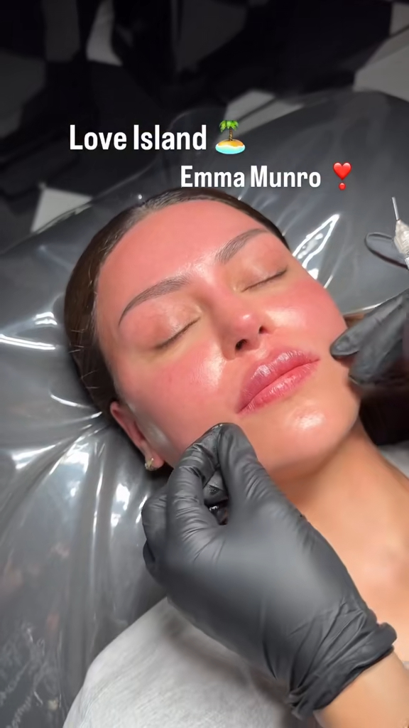 Love Island 2025 cast surgery