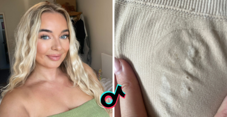 TikTok shop shapewear burns