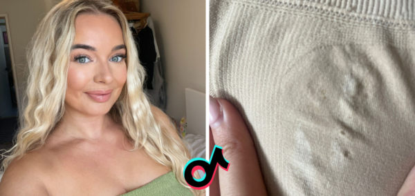 TikTok shop shapewear burns