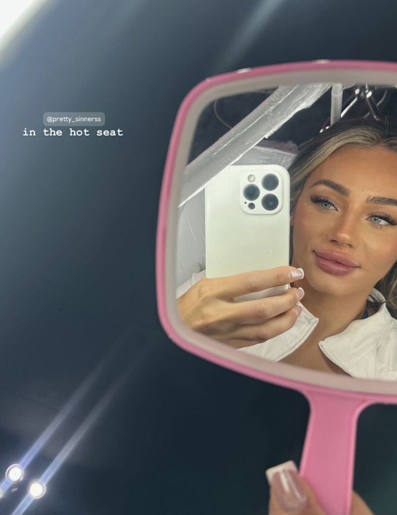 Meg Love Island 2025 lip filler