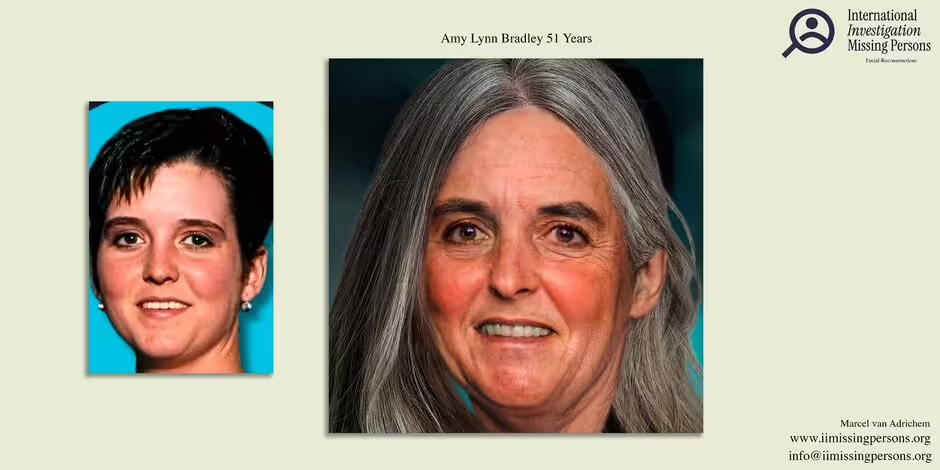 Amy Bradley new facial reconstruction what she would look like now