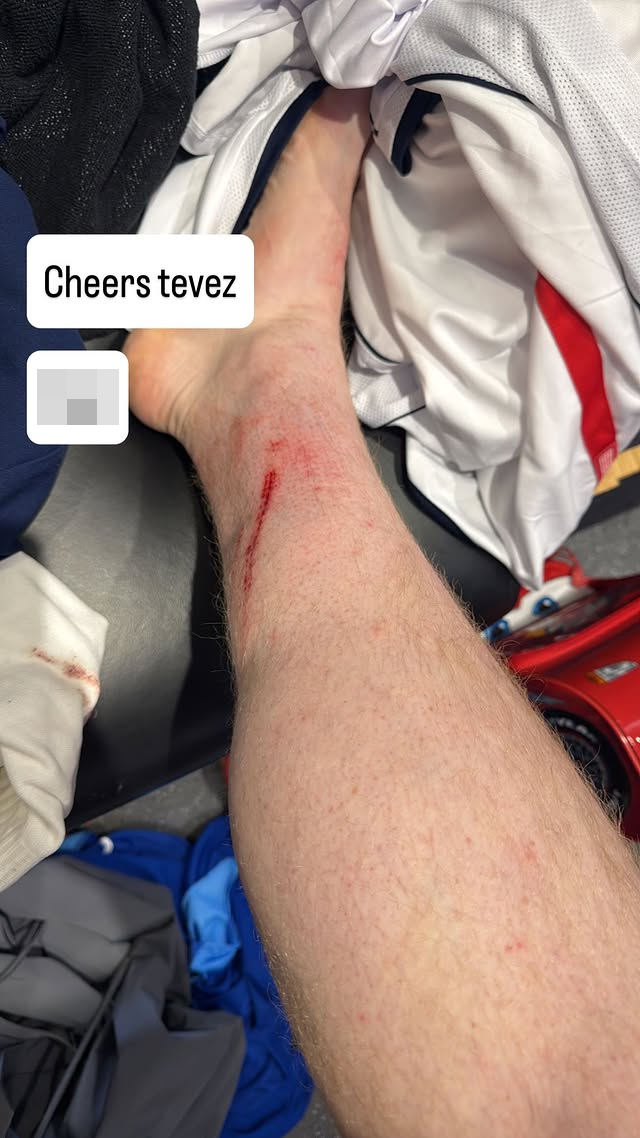 I'm A Celeb Angry Ginge controversial moments