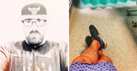 Man with smallest manhood speaks about struggle