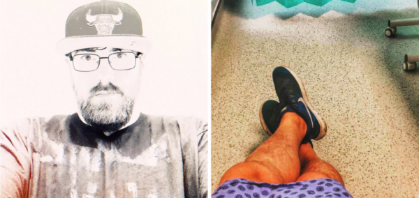 Man with smallest manhood speaks about struggle