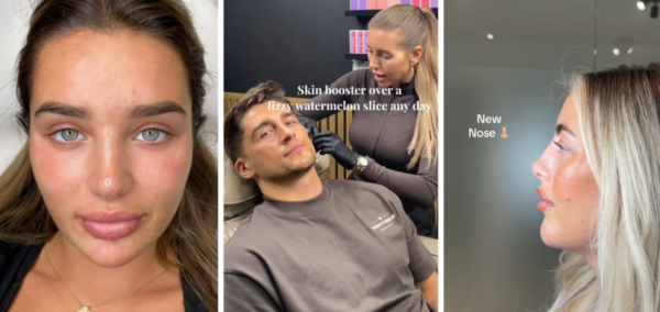 Love Island All Stars 2026 cast cosmetic work