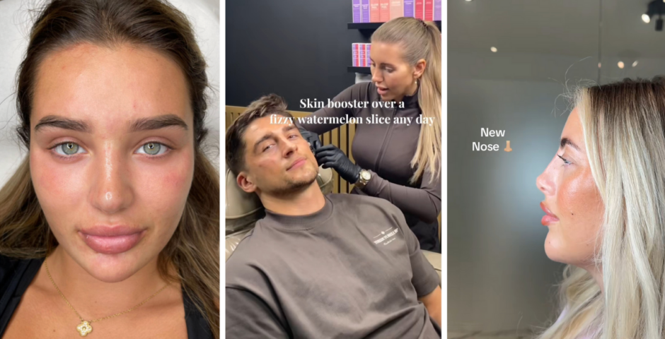 Love Island All Stars 2026 cast cosmetic work