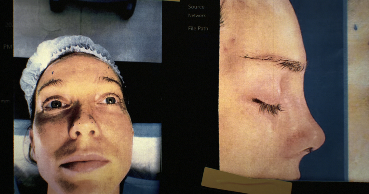 Kaitlin Armstrong plastic surgery